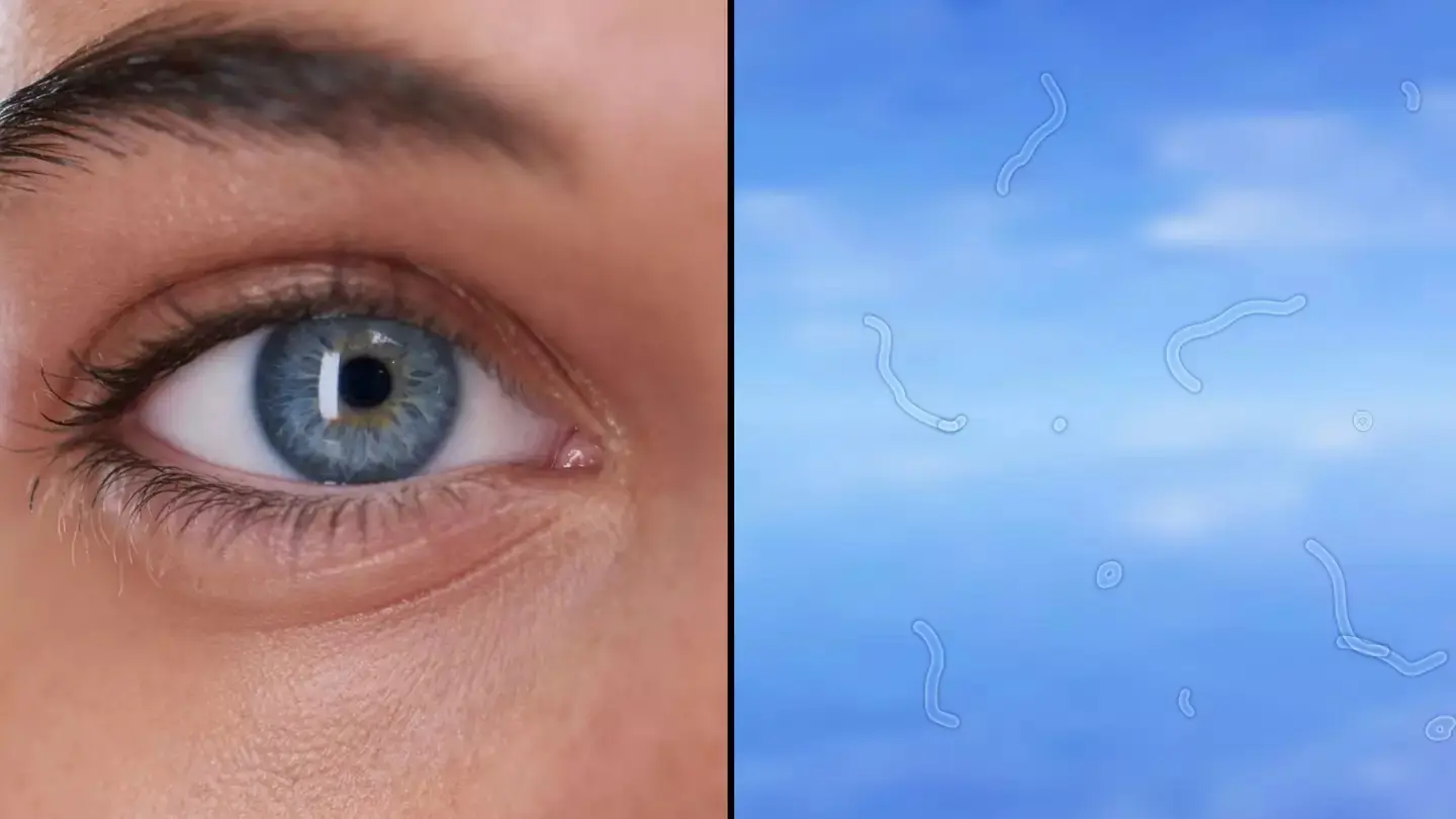 Eye Doctor Reveals What To Do If You Start Seeing ‘Floaters’
