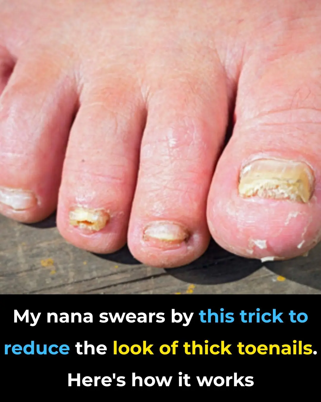 Nana’s Baking Soda Hack: The Surprisingly Effective Trick to Soften and Thin Thick Toenails