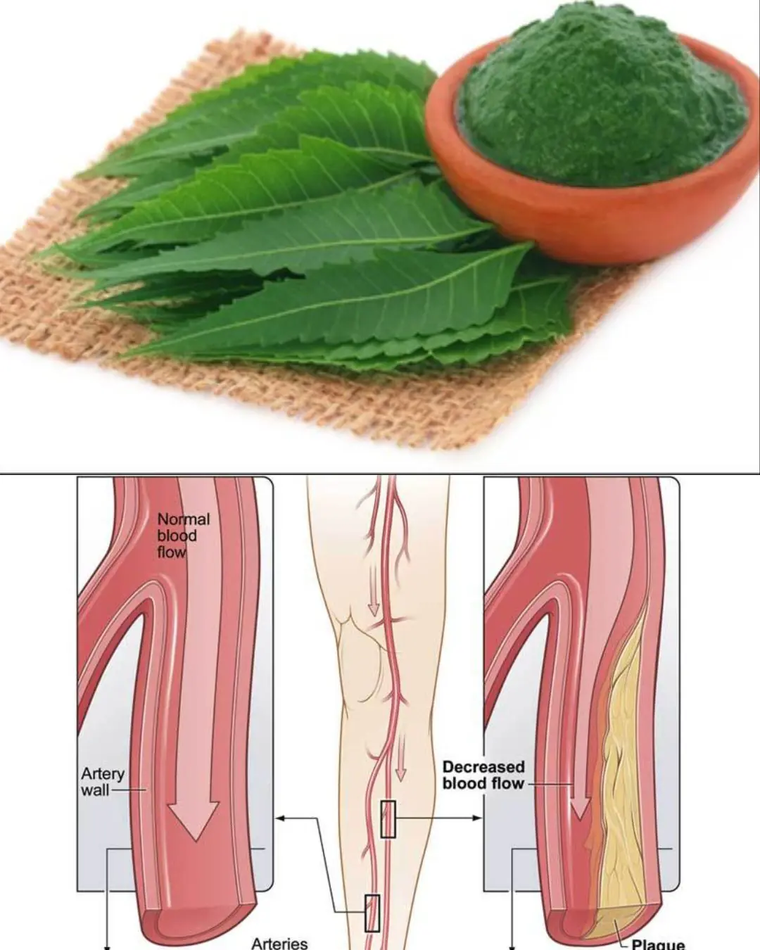 Neem: An Ancient Plant With Potential Health Benefits – What Science Says