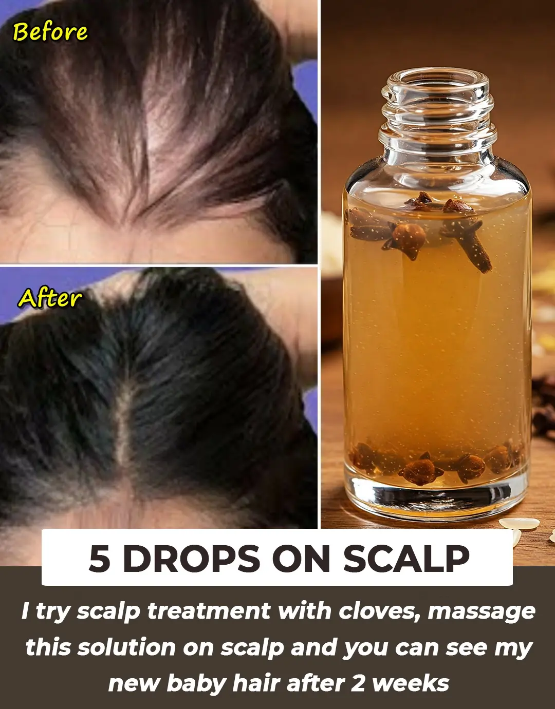 Fermented Rice Water & Cloves Scalp Treatment