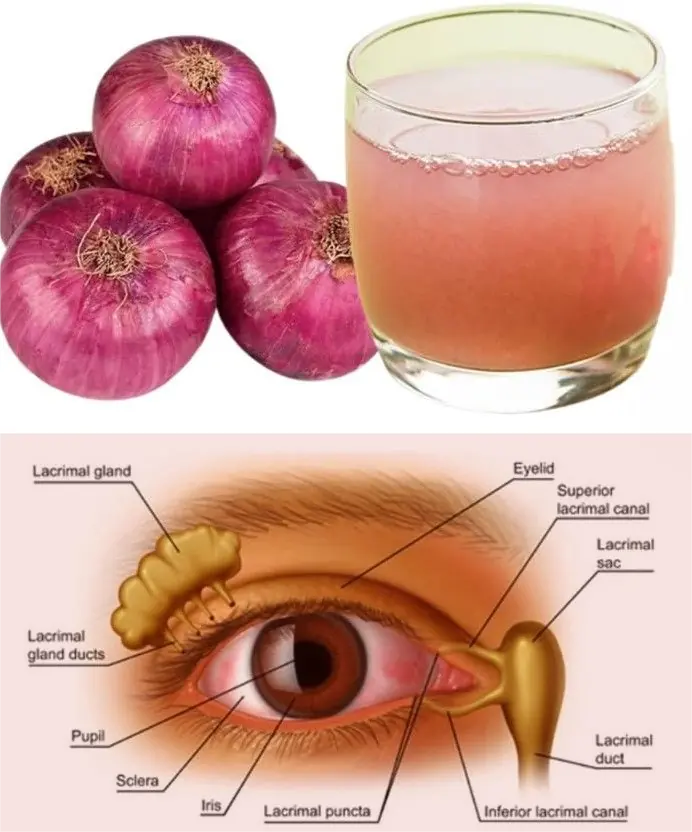 Can Onion Juice Gently Support Eye Health? A Natural Tip to Try