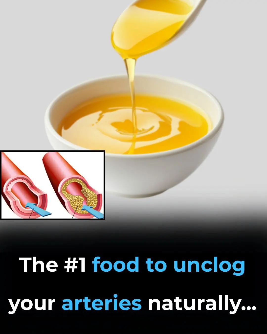 The #1 Food to Unclog Your Arteries Naturally