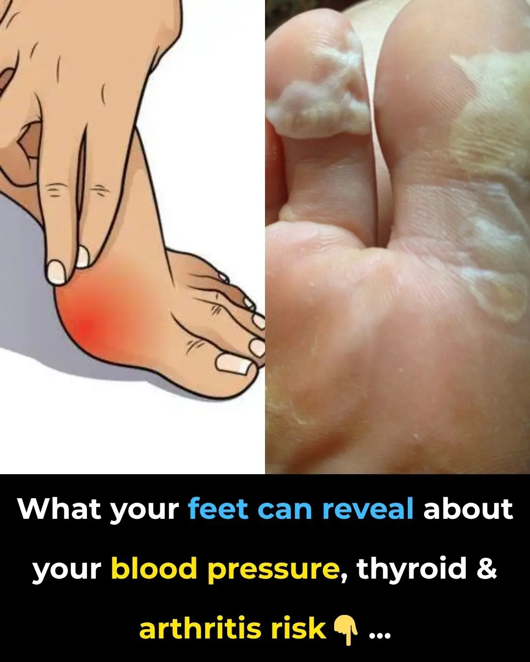 What Your Feet Can Reveal About Your Blood Pressure, Thyroid And Arthritis Risk