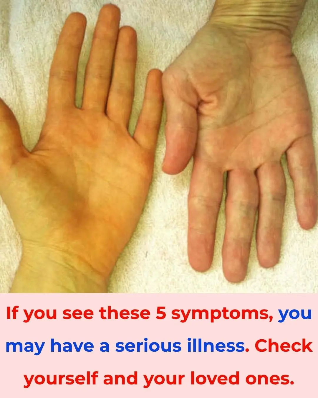 5 Warning Signs That Could Indicate a Serious Illness — Check Yourself and Your Loved Ones