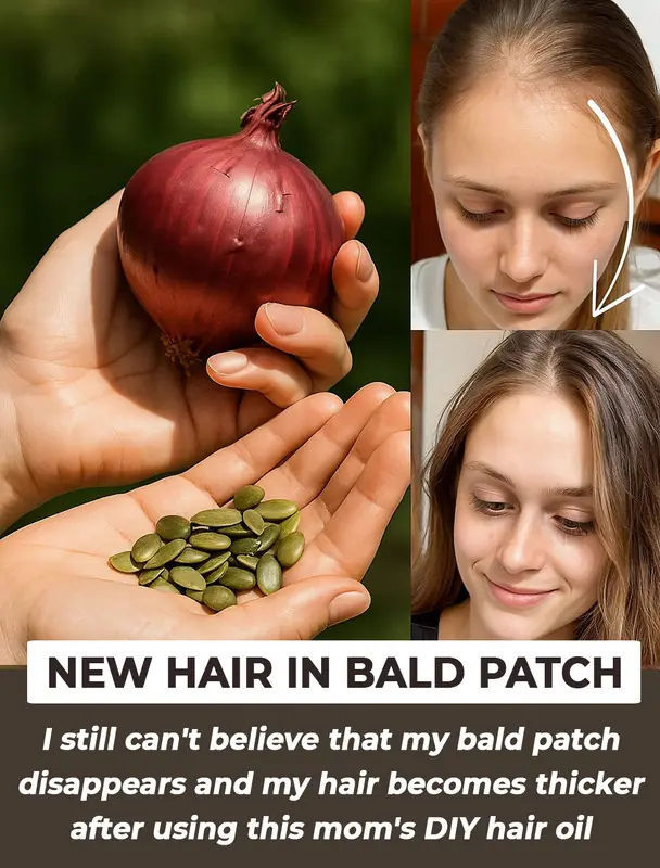 DIY Onion Sunflower Seed Oil: Get New Hair In Bald Patches