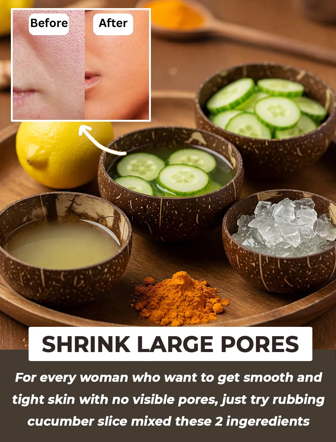 Top 5 Natural Remedies to Shrink Enlarged Pores and Achieve Smooth Skin