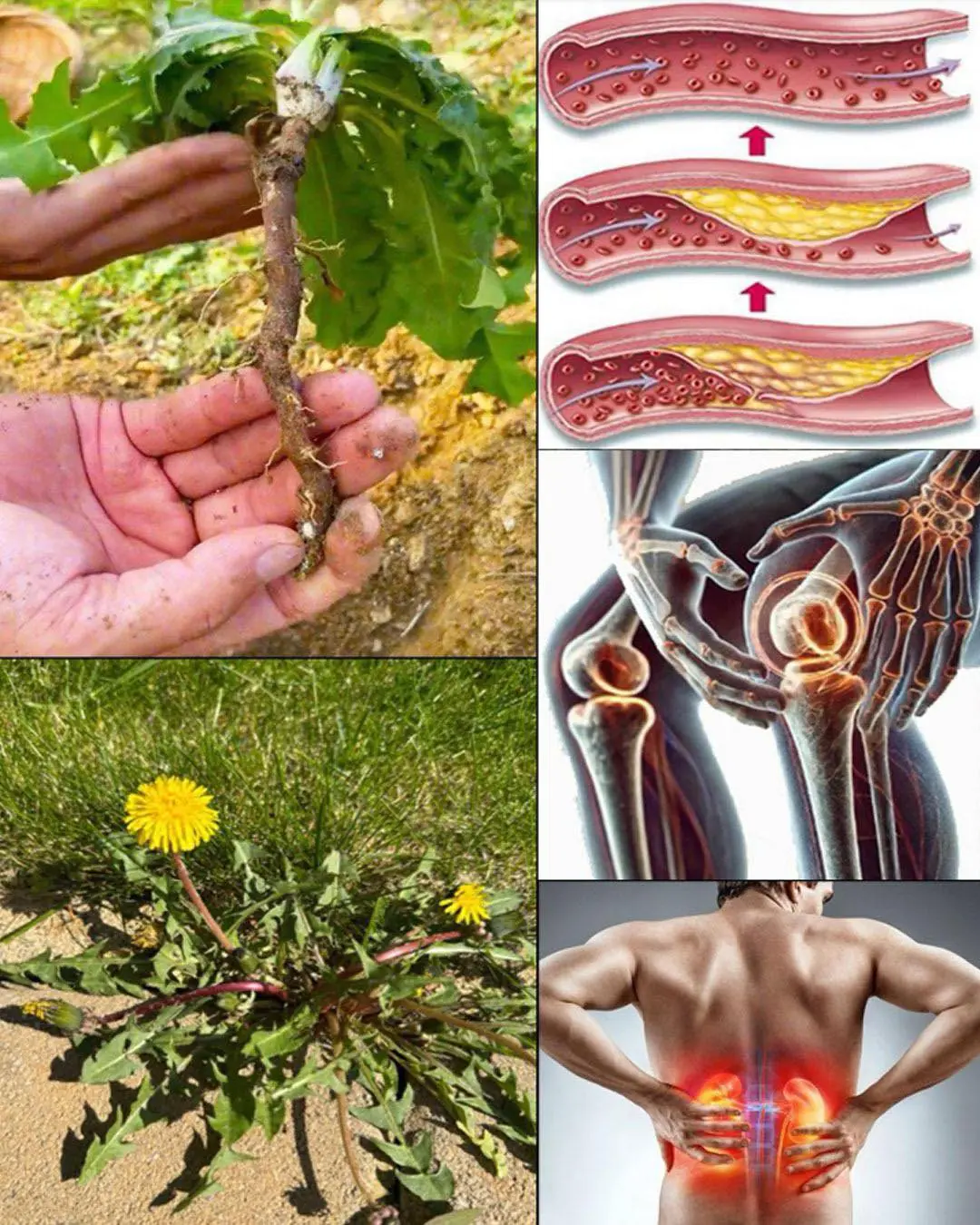 11 Benefits of Dandelion Roots