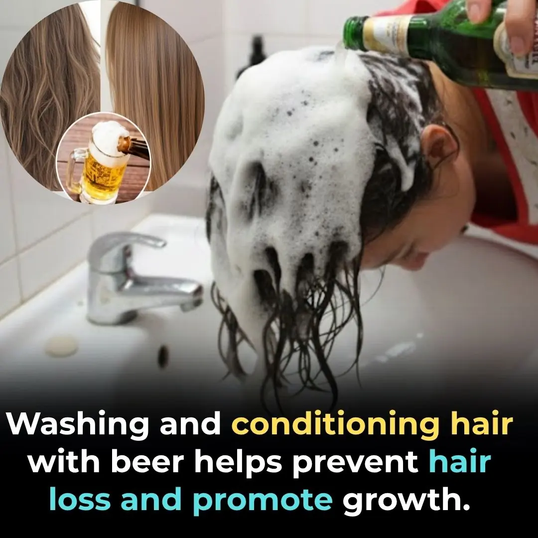 Washing and conditioning hair with beer helps reduce hair loss and stimulates continuous hair growth