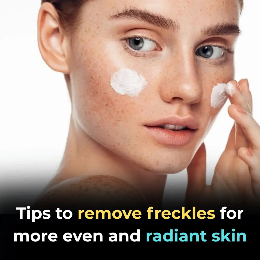 Tips to Fade Freckles for a More Even and Radiant Complexion