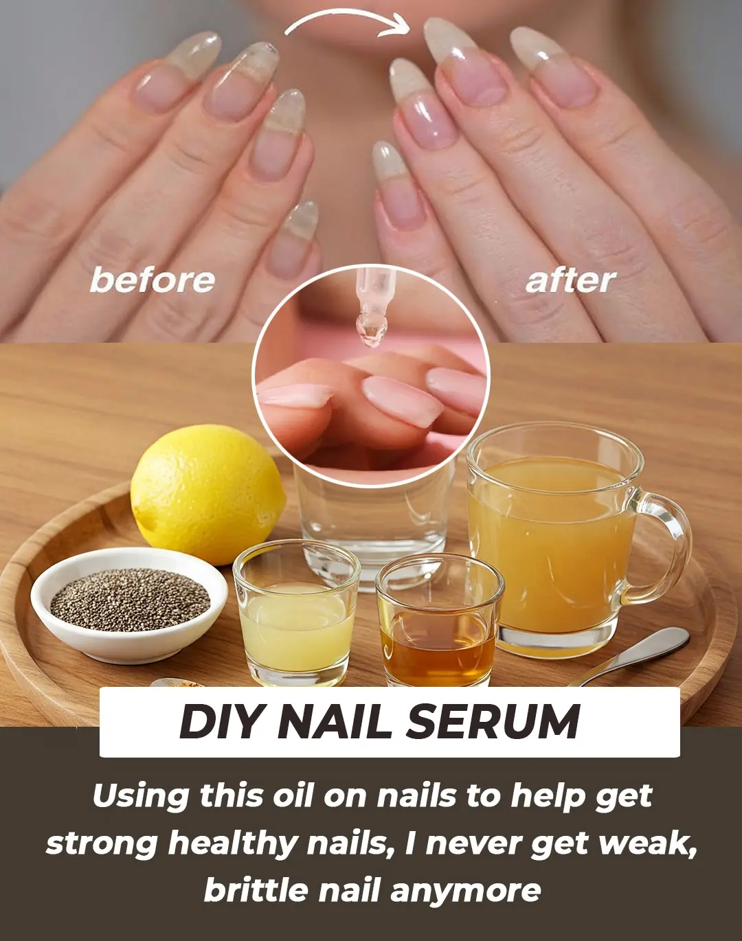 Use This DIY Nail Growth Serum For Longer, Beautiful Nails