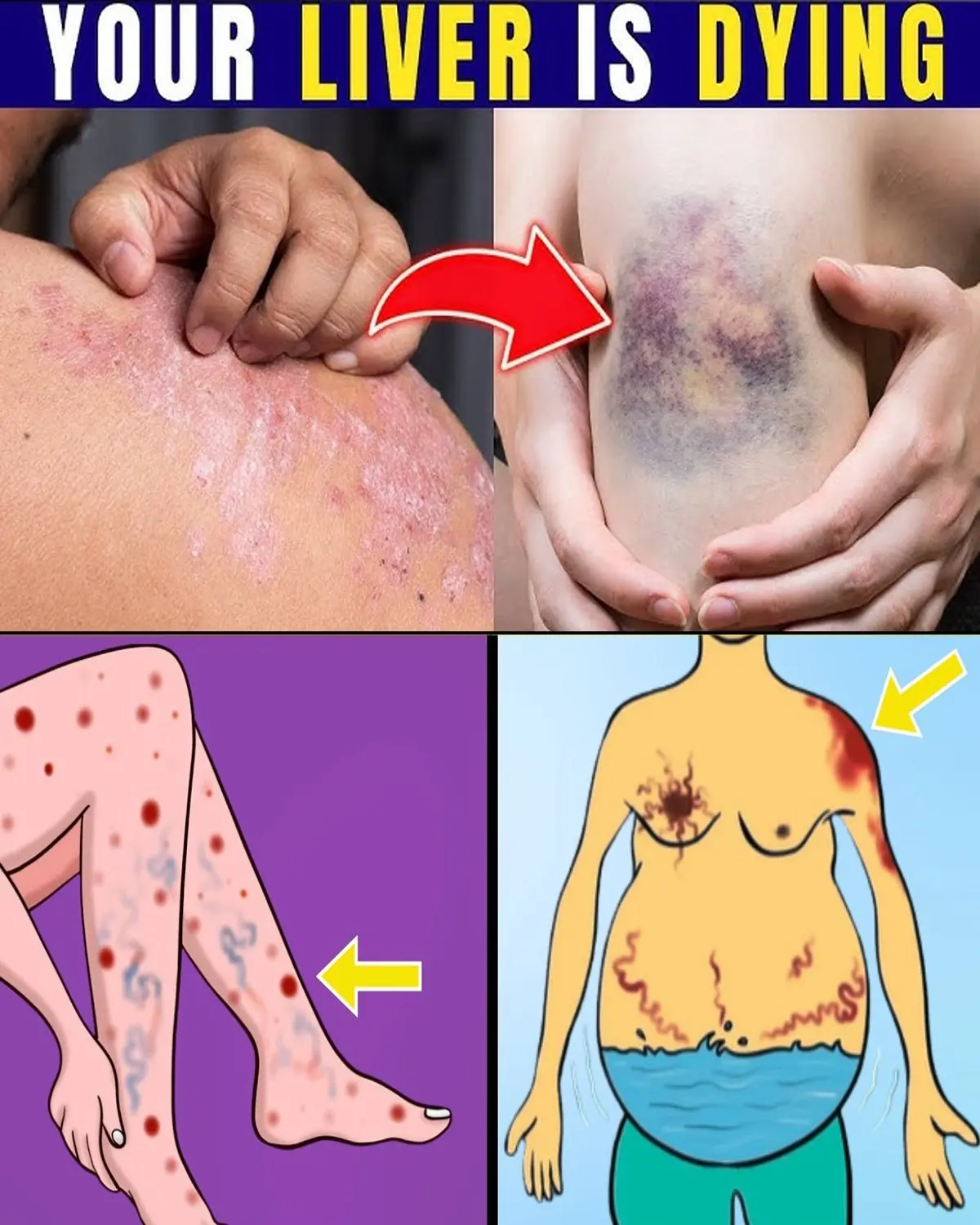 Warning: 12 Weird Signs That Show You’re Having Liver Damage