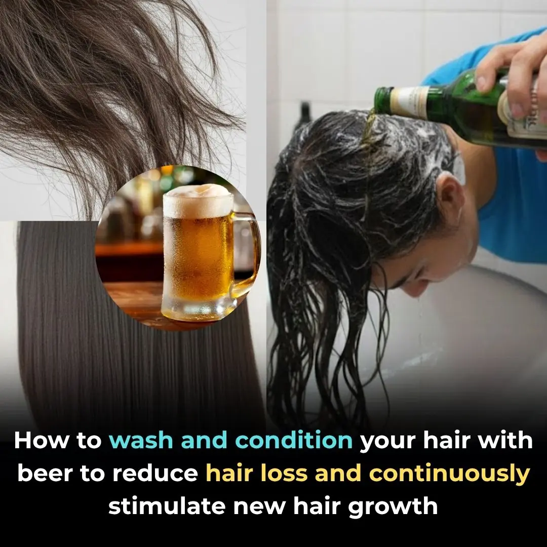 How to wash and condition your hair with beer to reduce hair loss and continuously stimulate new hair growth