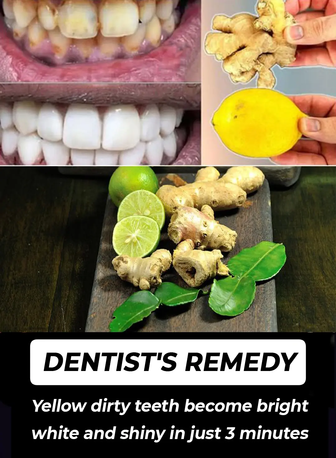 Instant Teeth Whitening: Ginger & Lemon Remedy for a Brighter Smile in 2 Minutes