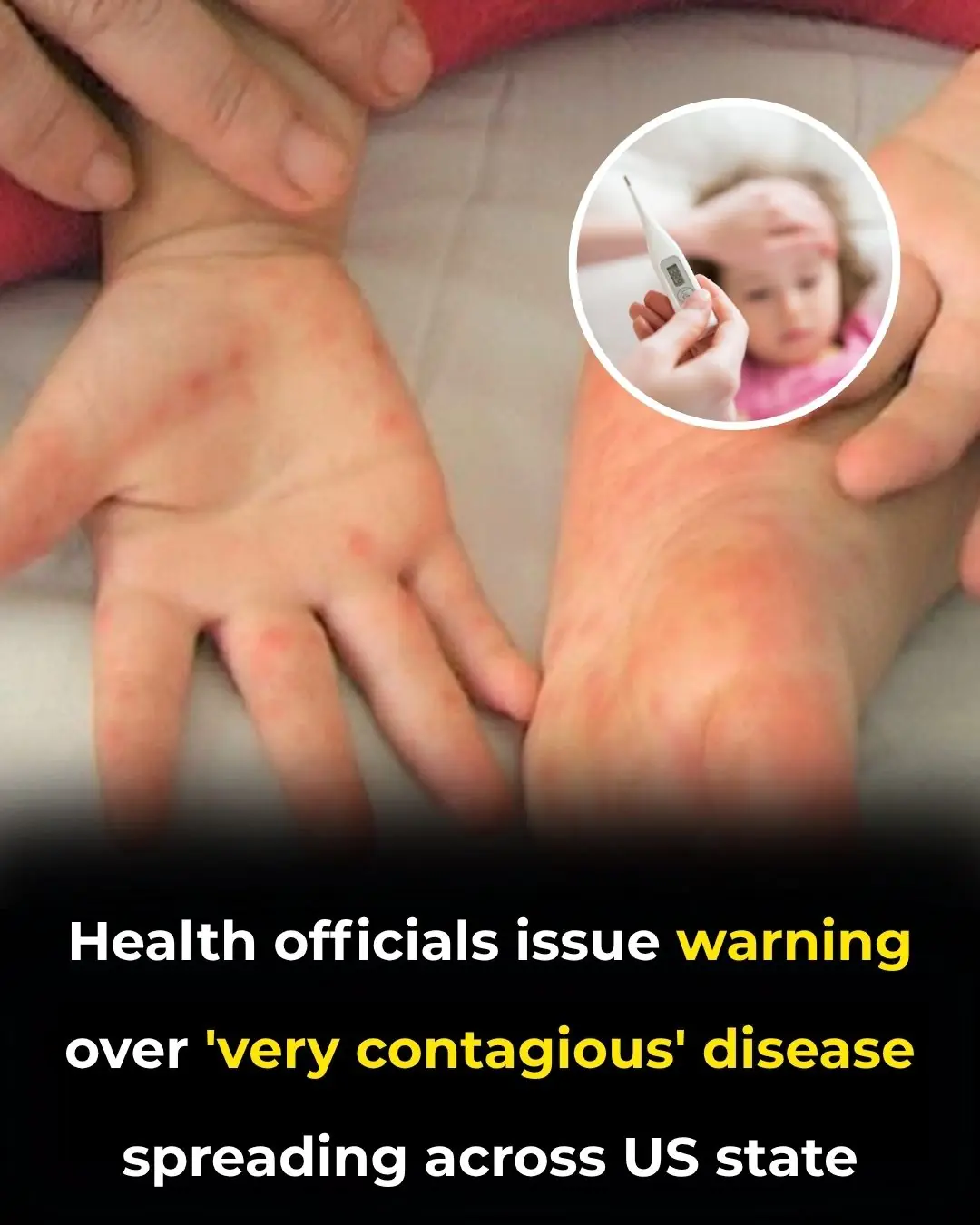 Health officials issue warning over ‘very contagious’ disease spreading across US state