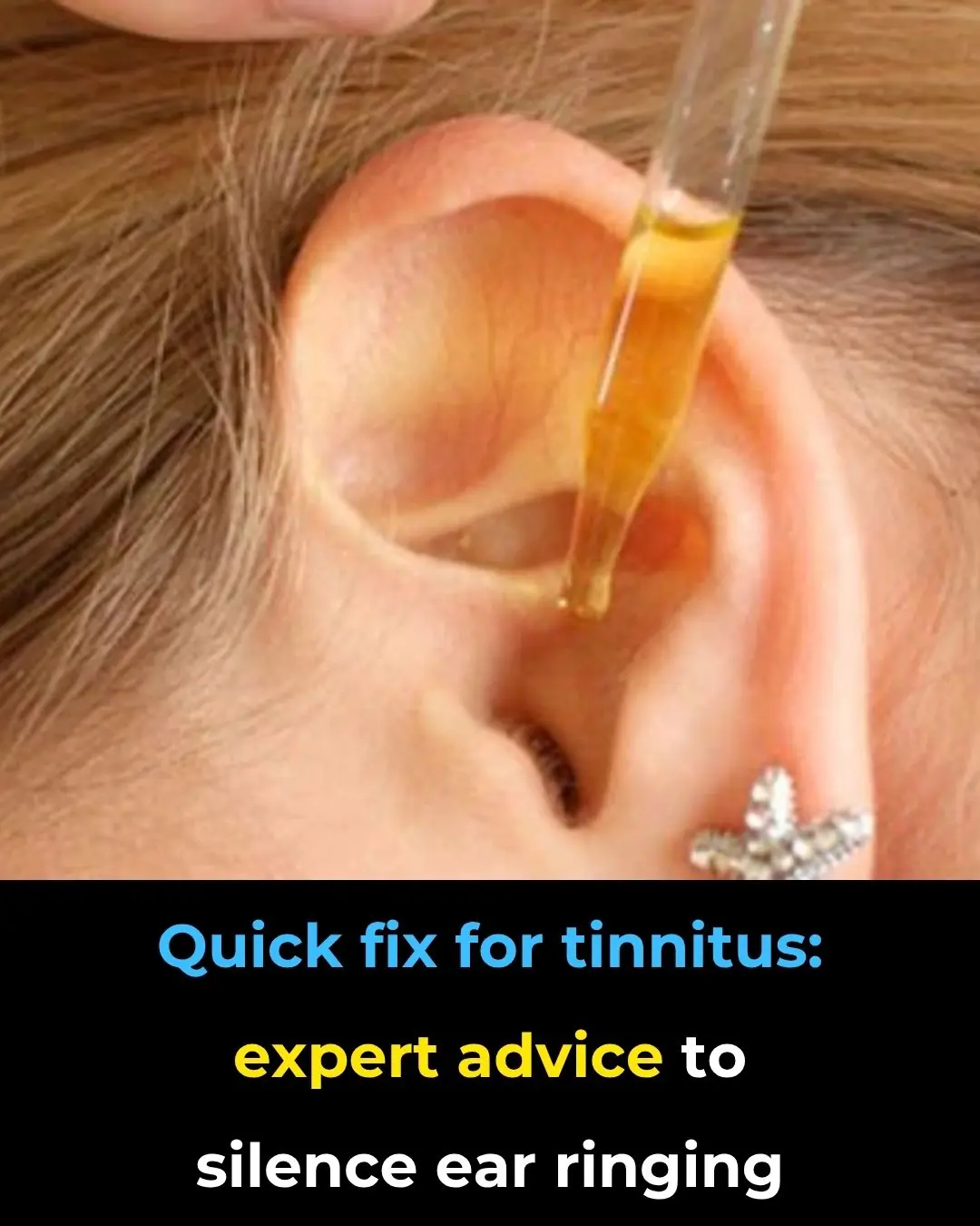 🔊 Hearing Loss: What Really Helps — And What Doesn’t