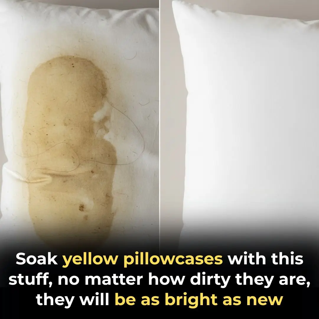 2 Ways to wash pillowcases until they turn yellow and white again like new
