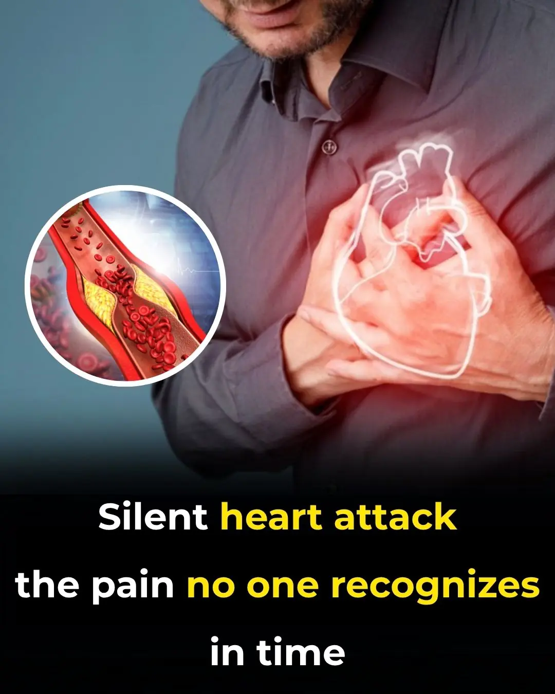Silent heart attack — the pain no one recognizes in time
