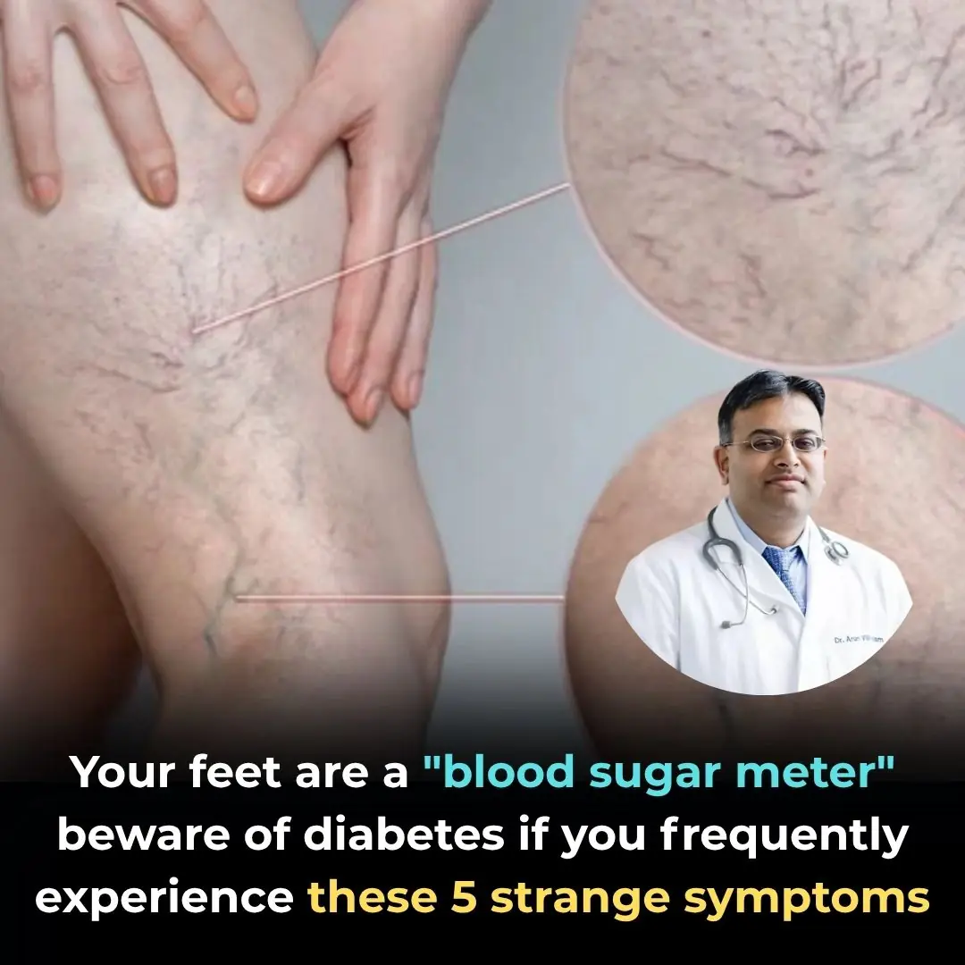🦶 Your Feet Are a "Blood Sugar Meter": Beware of Diabetes If You Frequently Experience These 5 Strange Symptoms