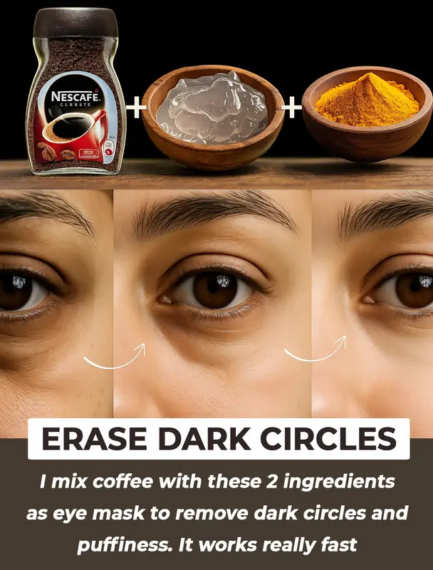 6 Coffee Eye Masks for Dark Circles, Wrinkles, Puffy Eyes, and Under-Eye Bags: A Natural Solution for Youthful, Bright Eyes