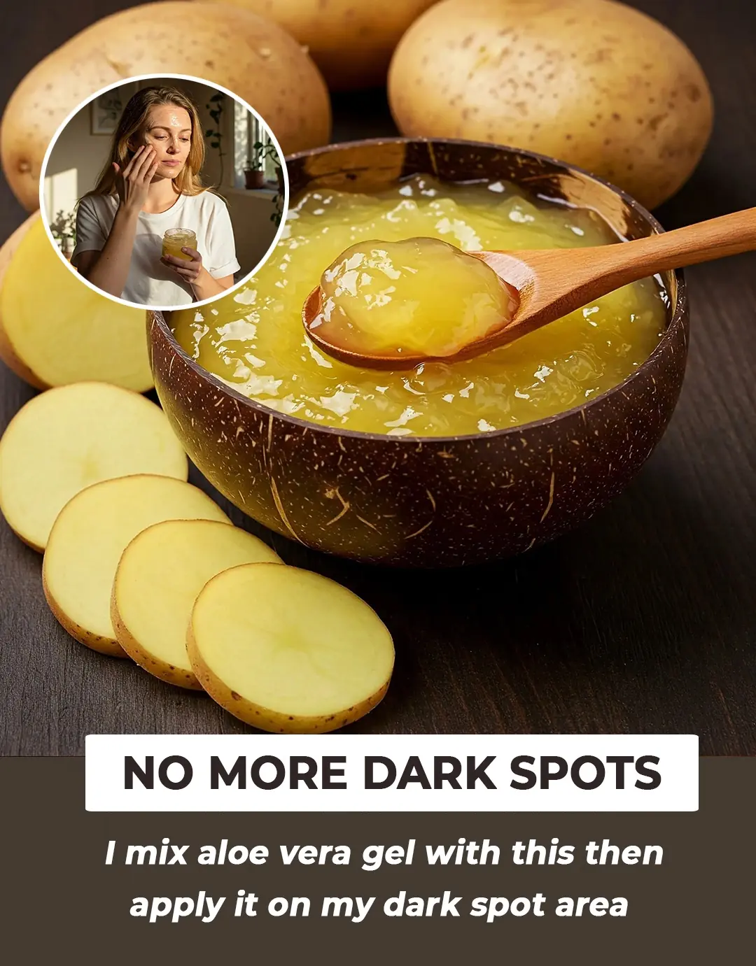 Potato Gel for Glowing Skin & Dark Spots