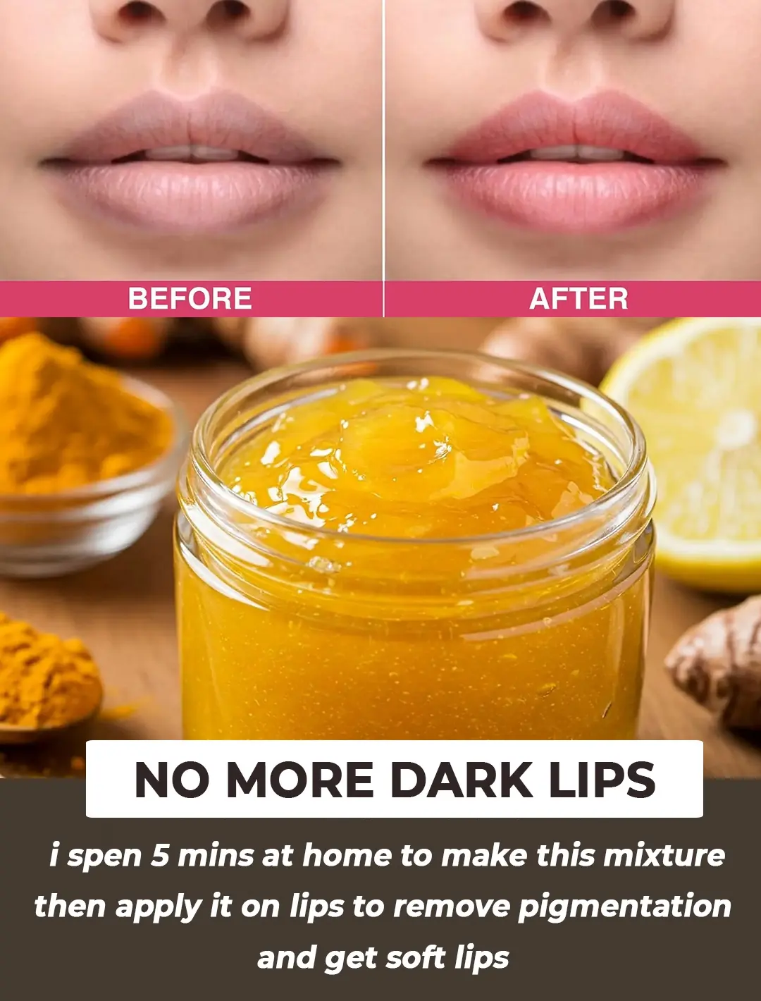 The Ultimate Guide to Dark Lips Treatment at Home: A Simple 3-Step Routine for Pigmented Lips