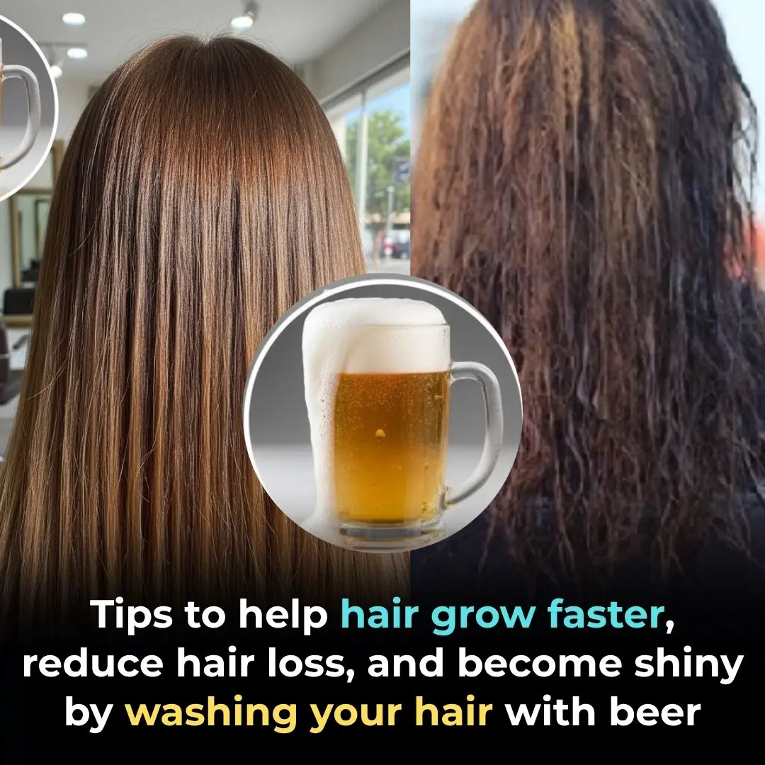 Tips for Faster Hair Growth, Reduced Hair Loss, and Shiny Hair Using Beer Hair Wash