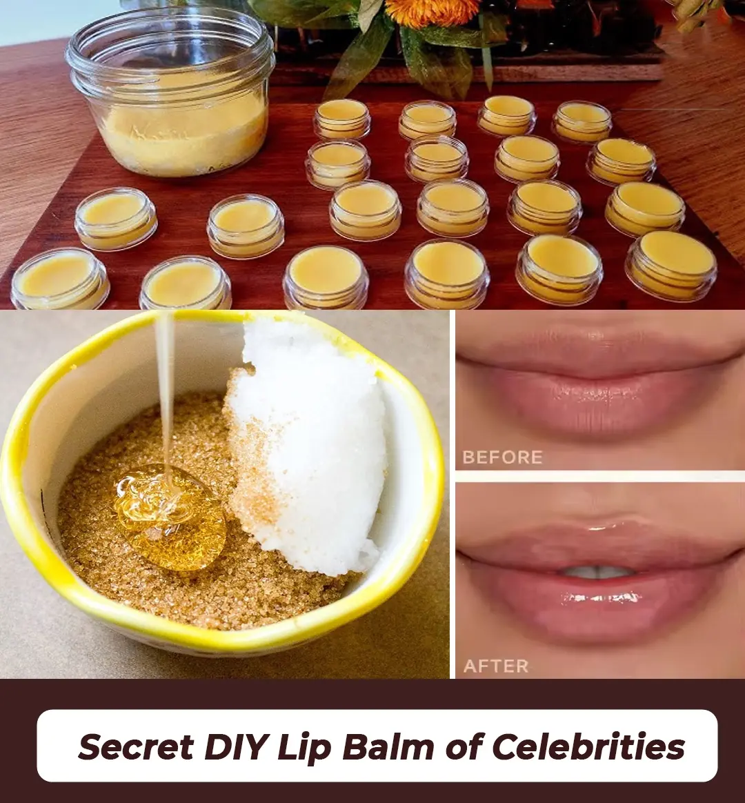 How to Treat a Pimple on the Lip: Causes, Remedies, and Prevention Tips