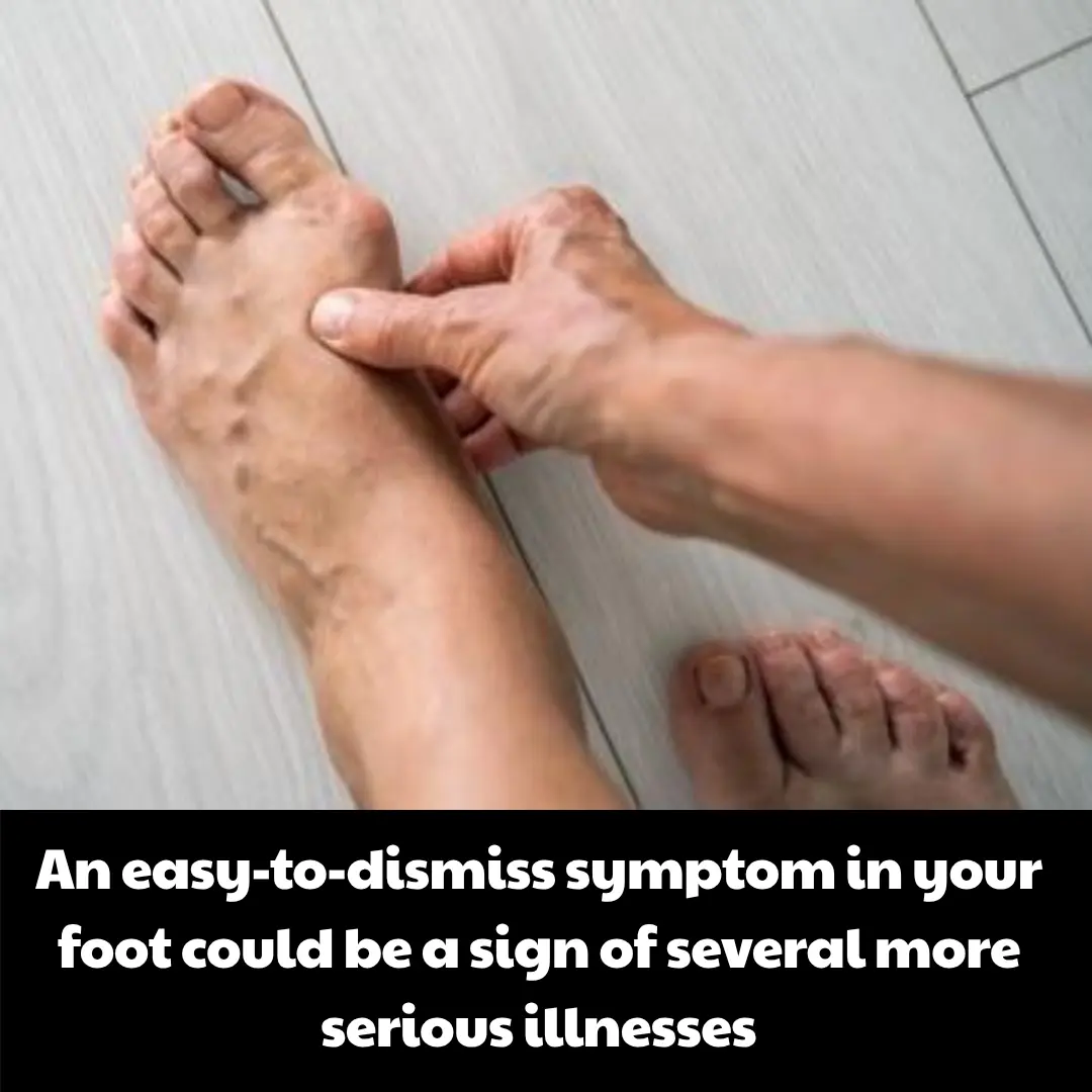 An easy-to-dismiss symptom in your foot could be a sign of several more serious illnesses