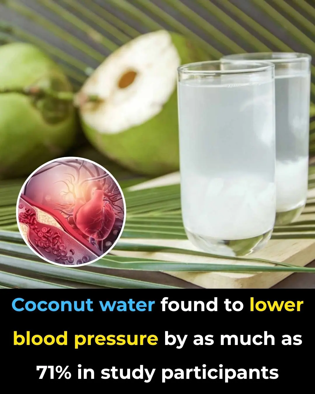 Coconut Water Found To Lower Blood Pressure By As Much As 71% In Study Participants