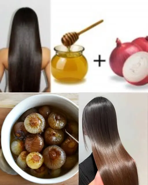 Red Onion for Hair Growth: How This Overlooked Natural Remedy Can Stop Hair Fall and Boost Thickness Fast