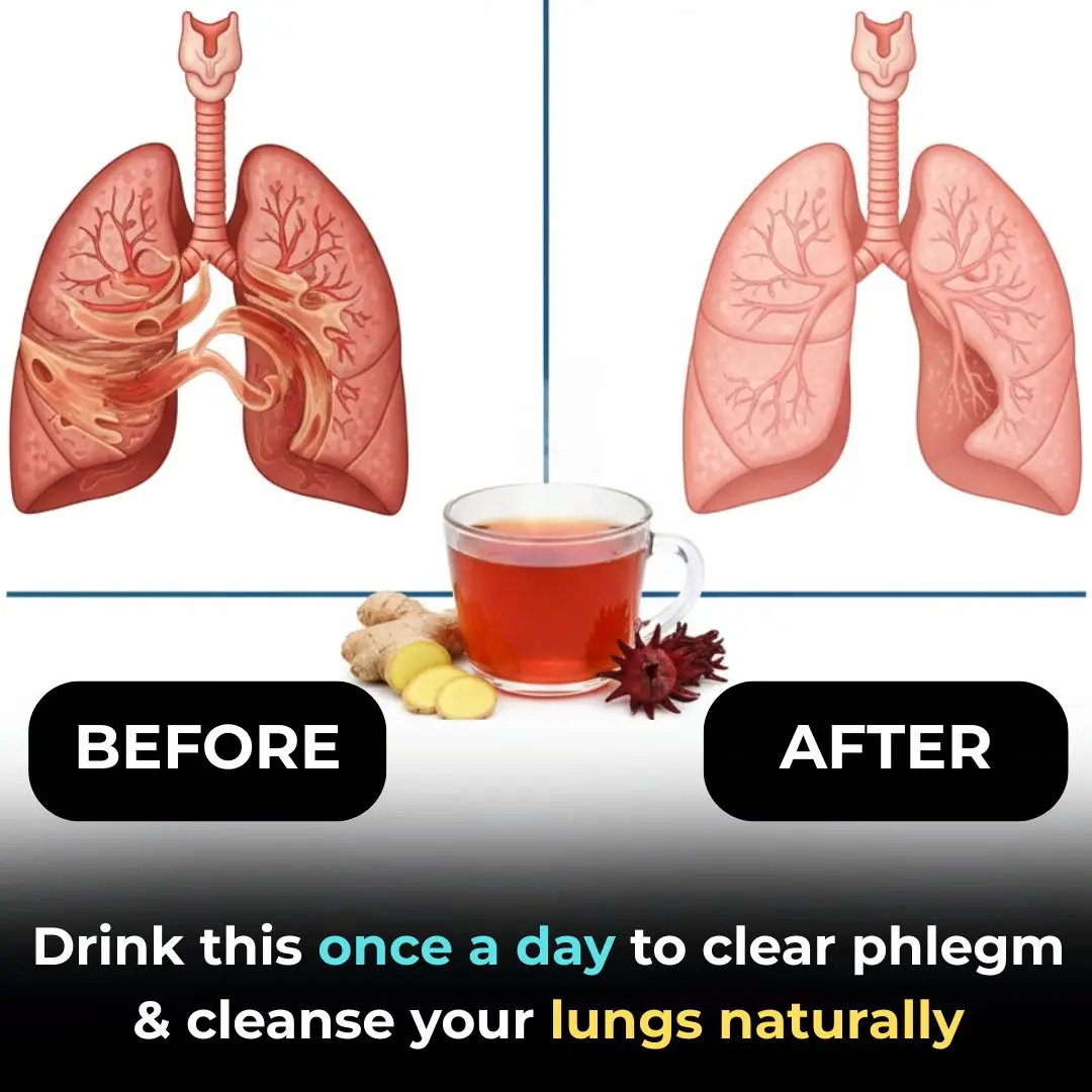 1 Cup to Cleanse Your Lungs of Phlegm and Toxins