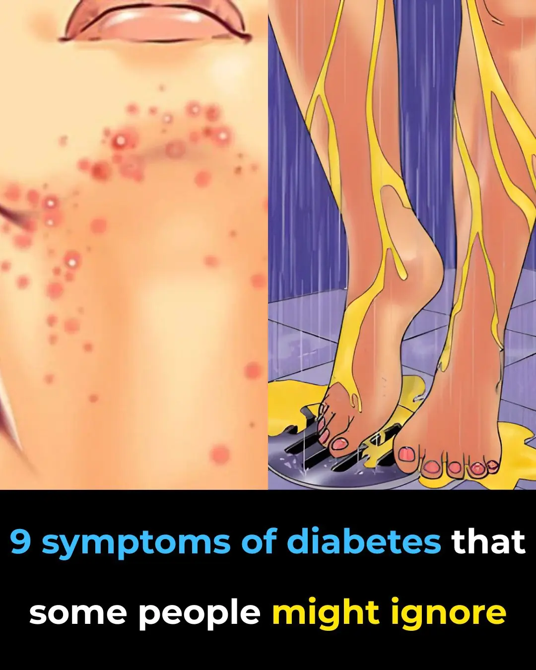 9 Warning Signs of Diabetes You Shouldn’t Ignore