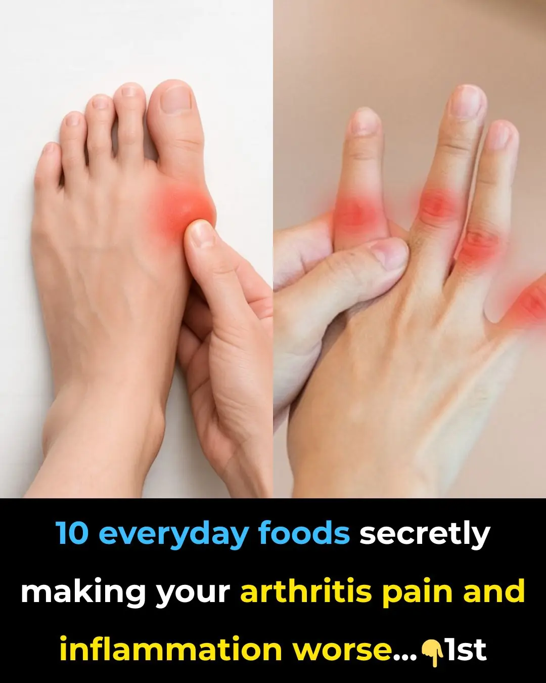 Arthritis warning: 10 everyday foods making your pain and inflammation worse