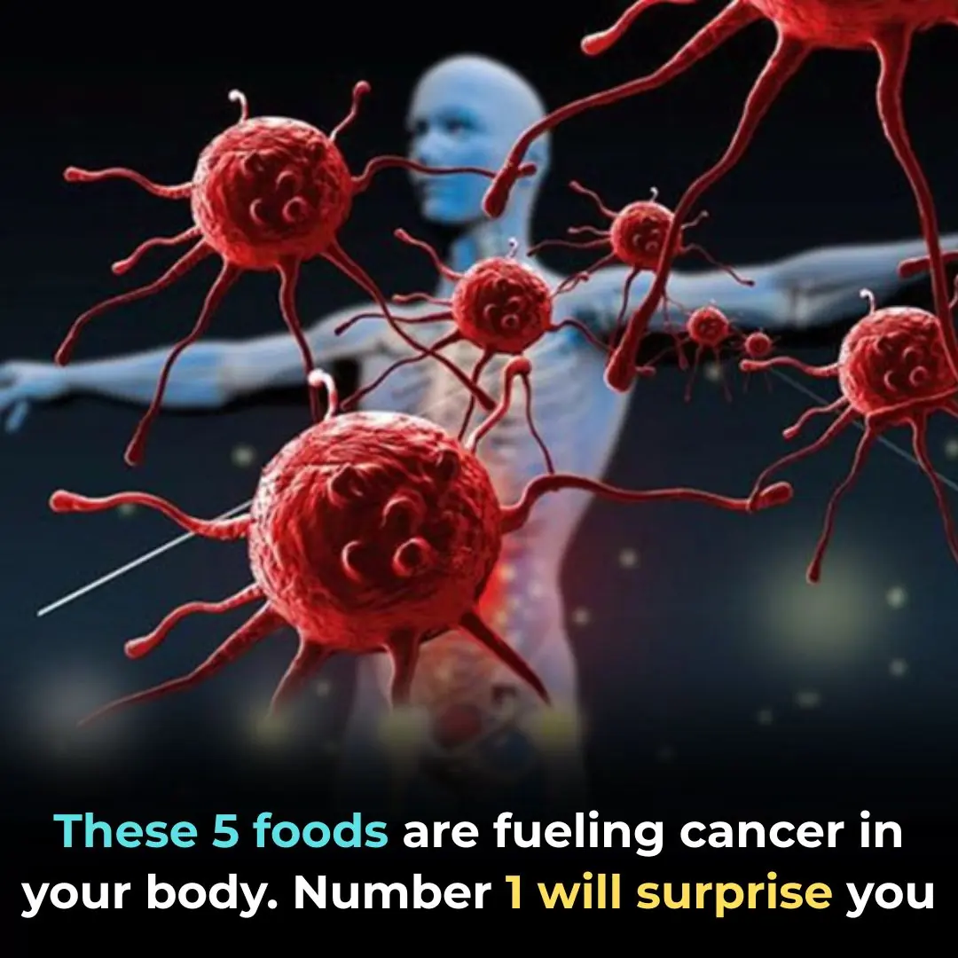 Why Hot Dogs and Processed Meat Might Be the Most Dangerous Foods of All Time