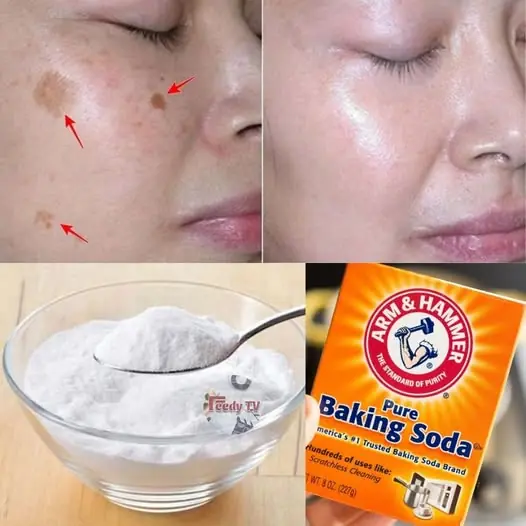 4 Ways To Erase Age Spots with Baking Soda for Youthful Even Skin