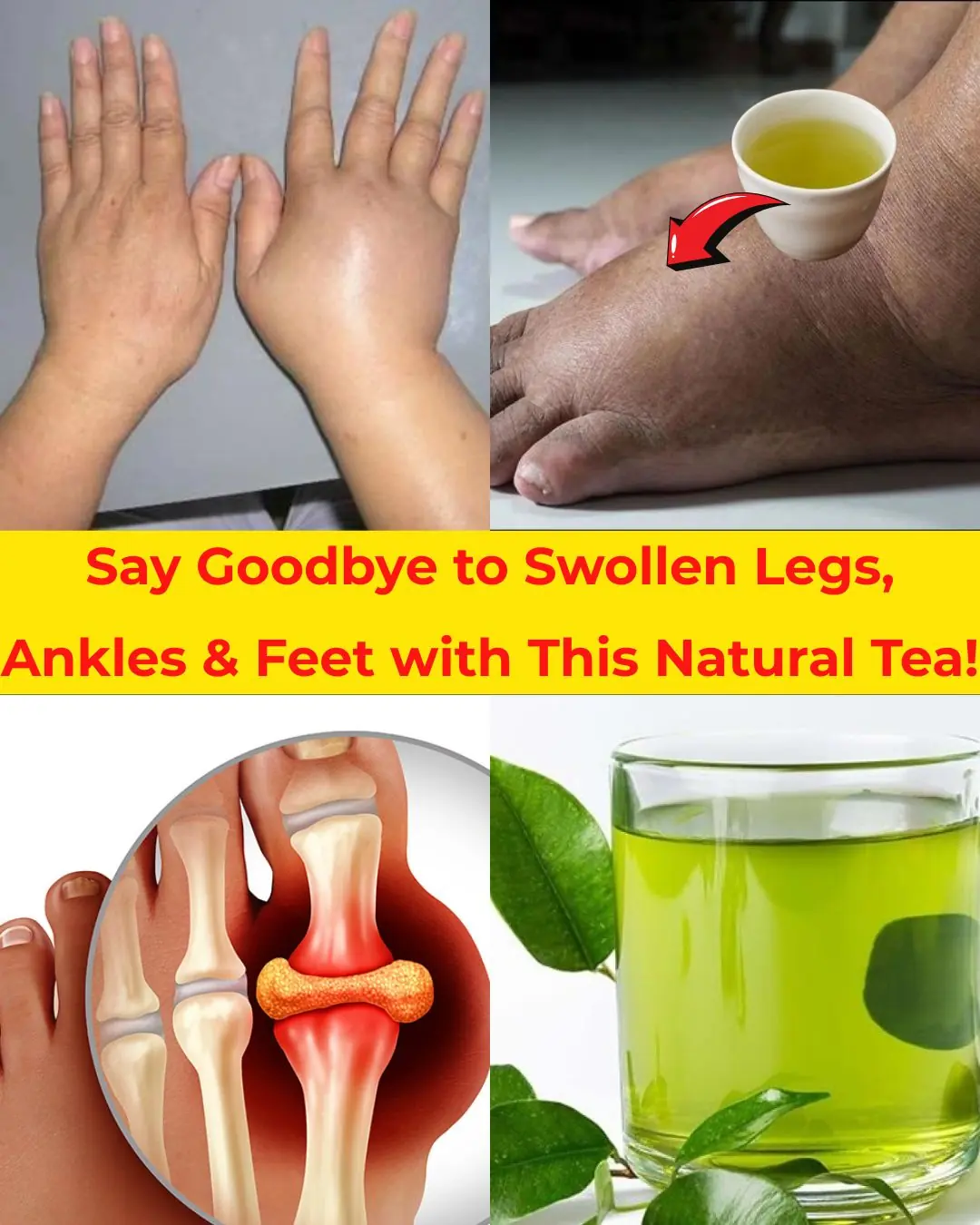 Say Goodbye to Swollen Legs