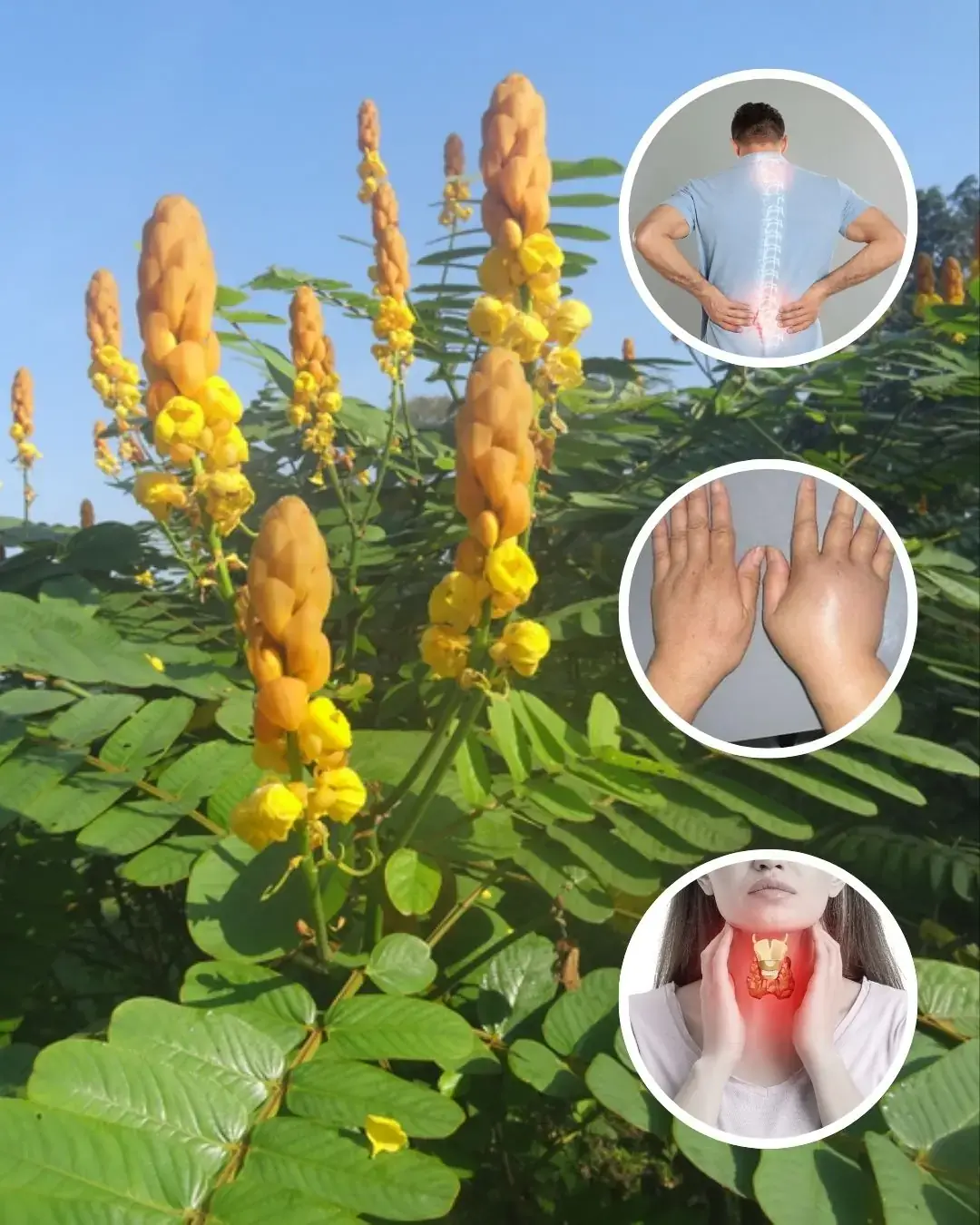 Senna Alexandrina: 7 Benefits and uses