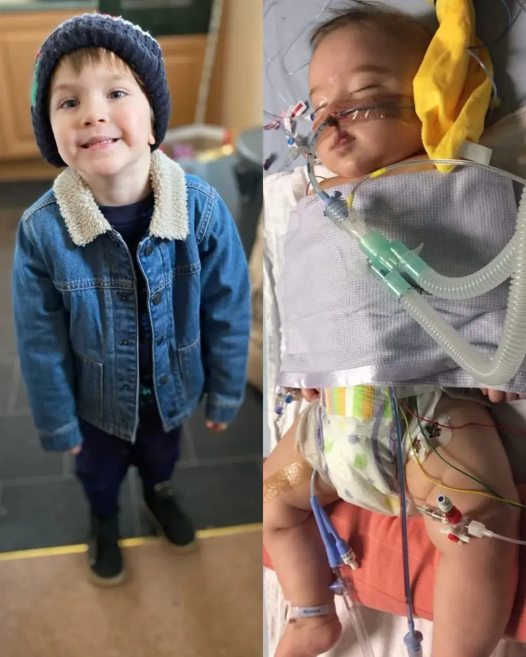 A Mother’s Courage: Lia and Oscar’s Journey Through a Fragile Heart