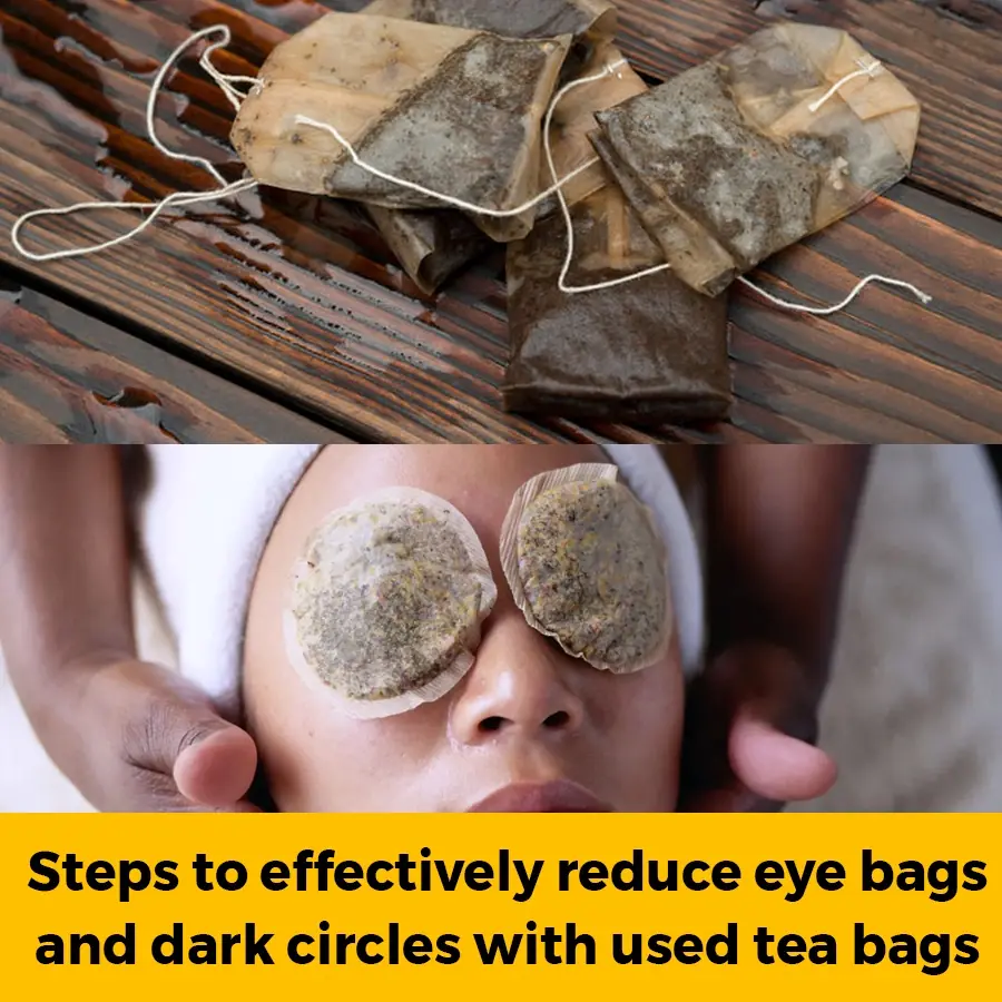 How to Use Tea Bags on Your Eyes: A Natural Remedy for Dark Circles, Puffiness, and More