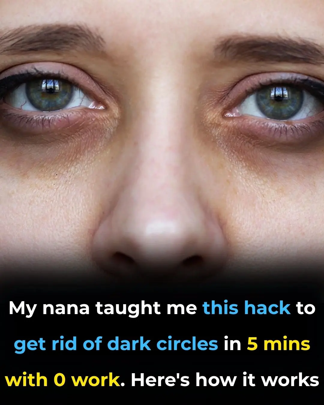 My nana taught me this hack to get rid of dark circles in 5 mins with 0 work. Here’s how it works