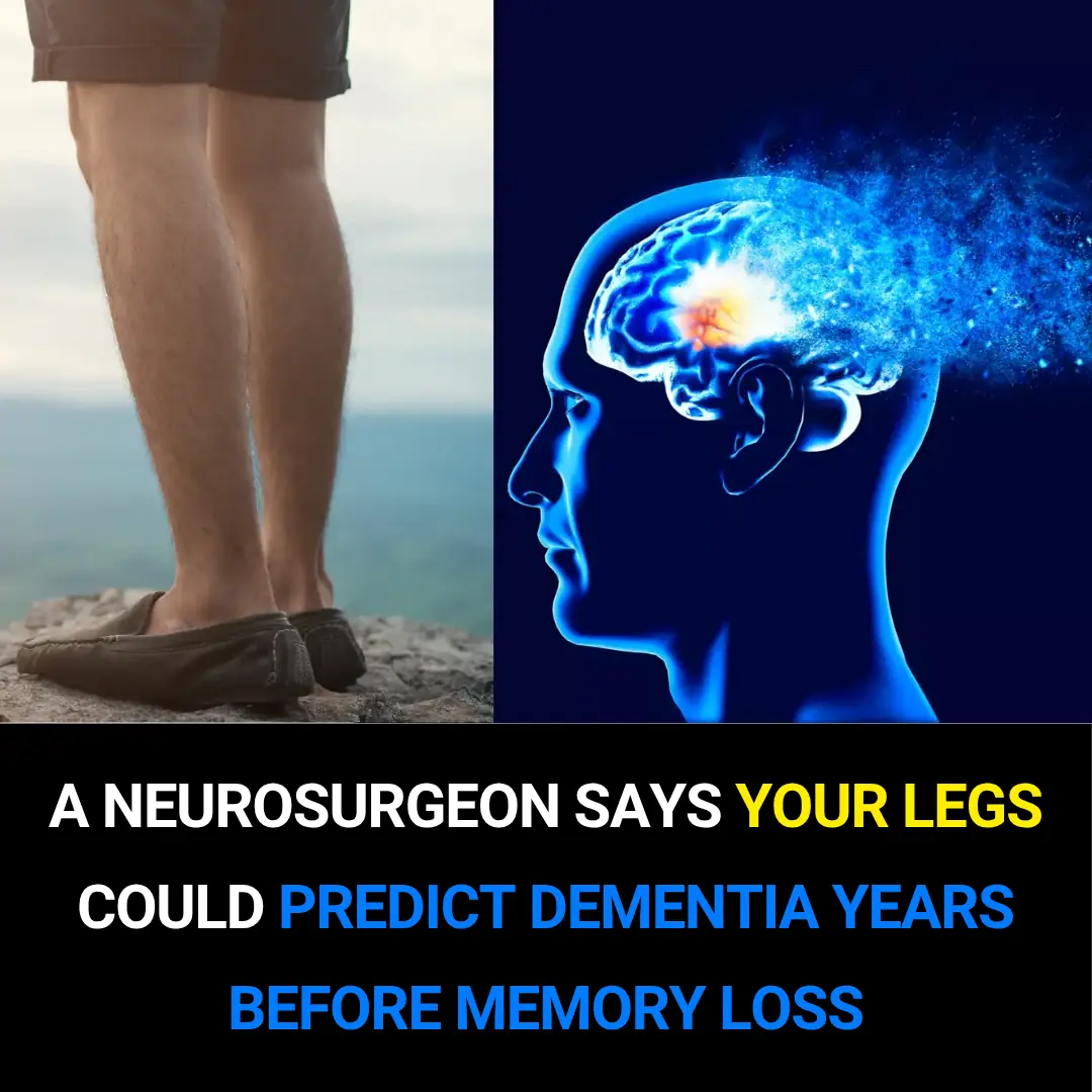 🧠 A Neurosurgeon Says Your Legs Could Predict Dementia Years Before Memory Loss
