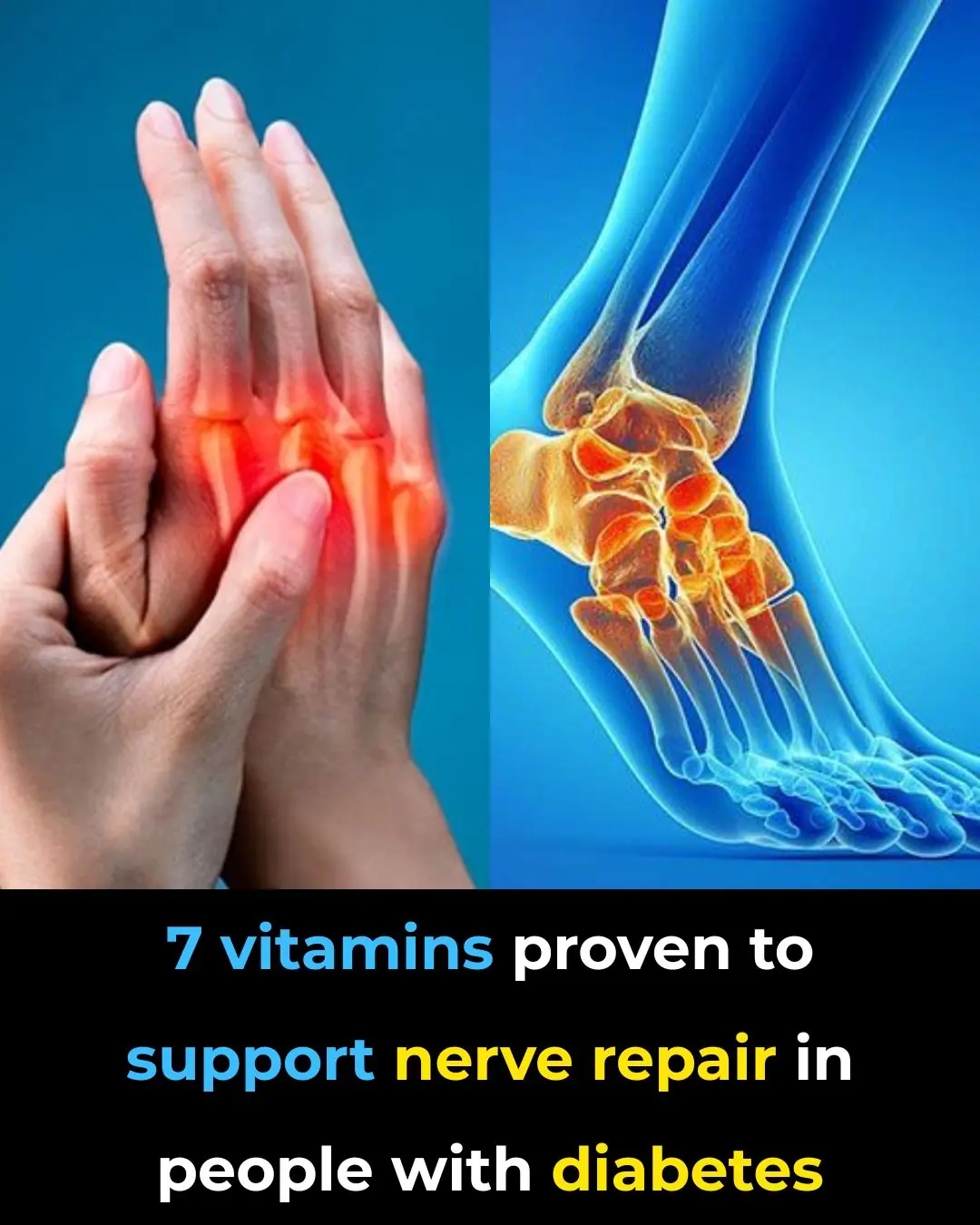 7 essential vitamins every diabetic needs for nerve health