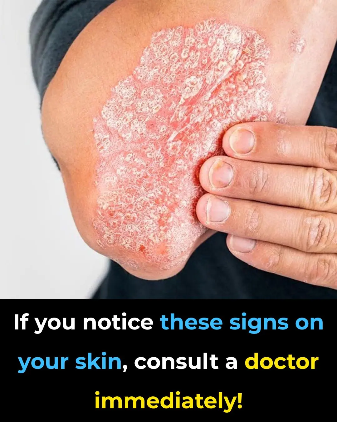 Warning Signs You Should Never Ignore on Your Skin