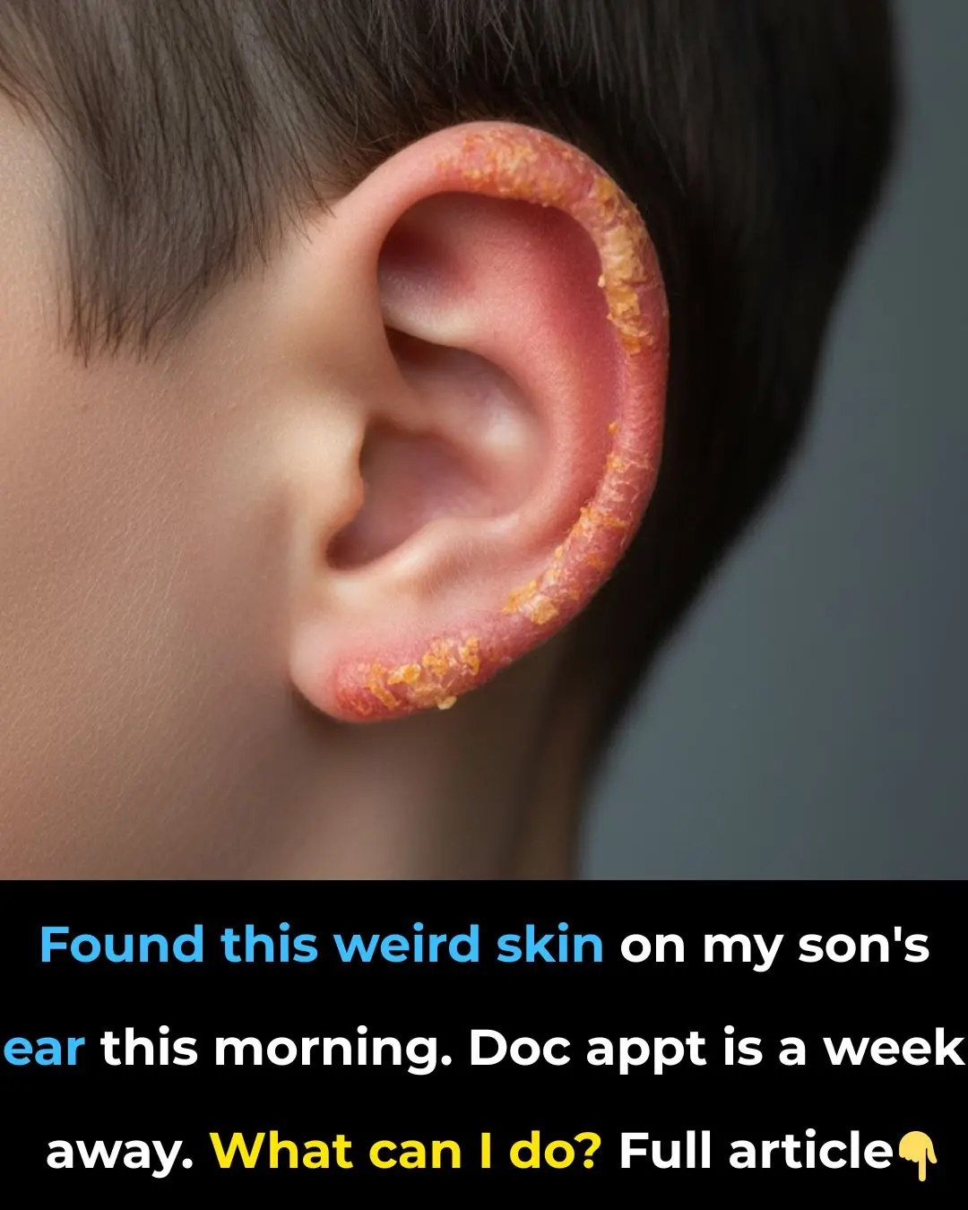 Found this weird skin on my son's ear this morning. Doc appt is a week away. What can I do?