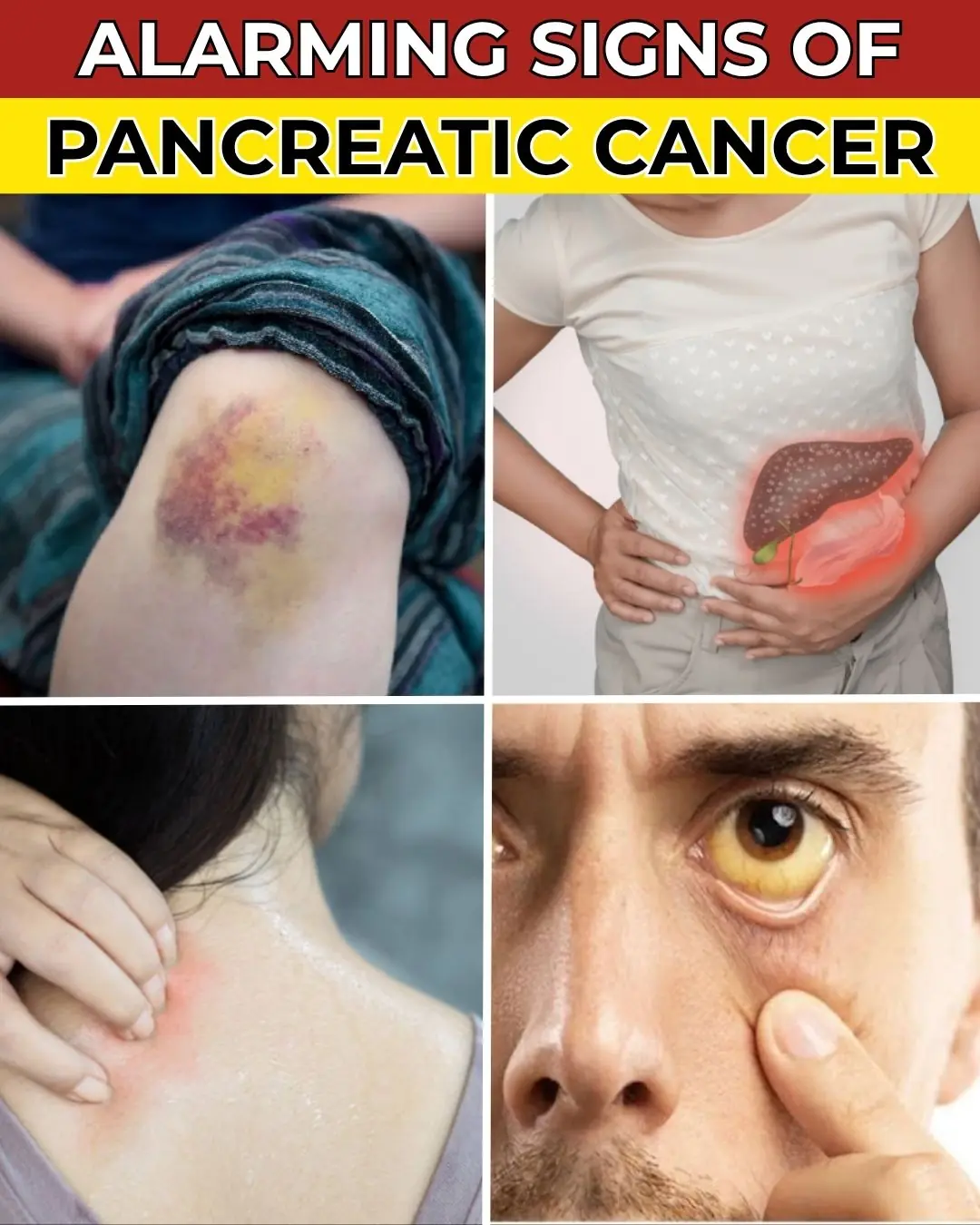 DON'T IGNORE! Top 8 Warning Signs Of Blood Clots