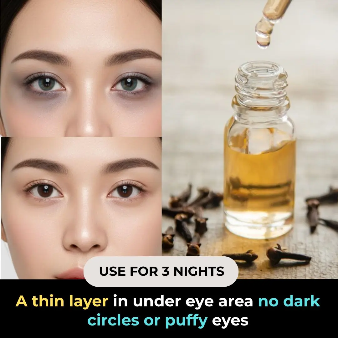 DIY Under-Eye Clove Cream for Dark Circles