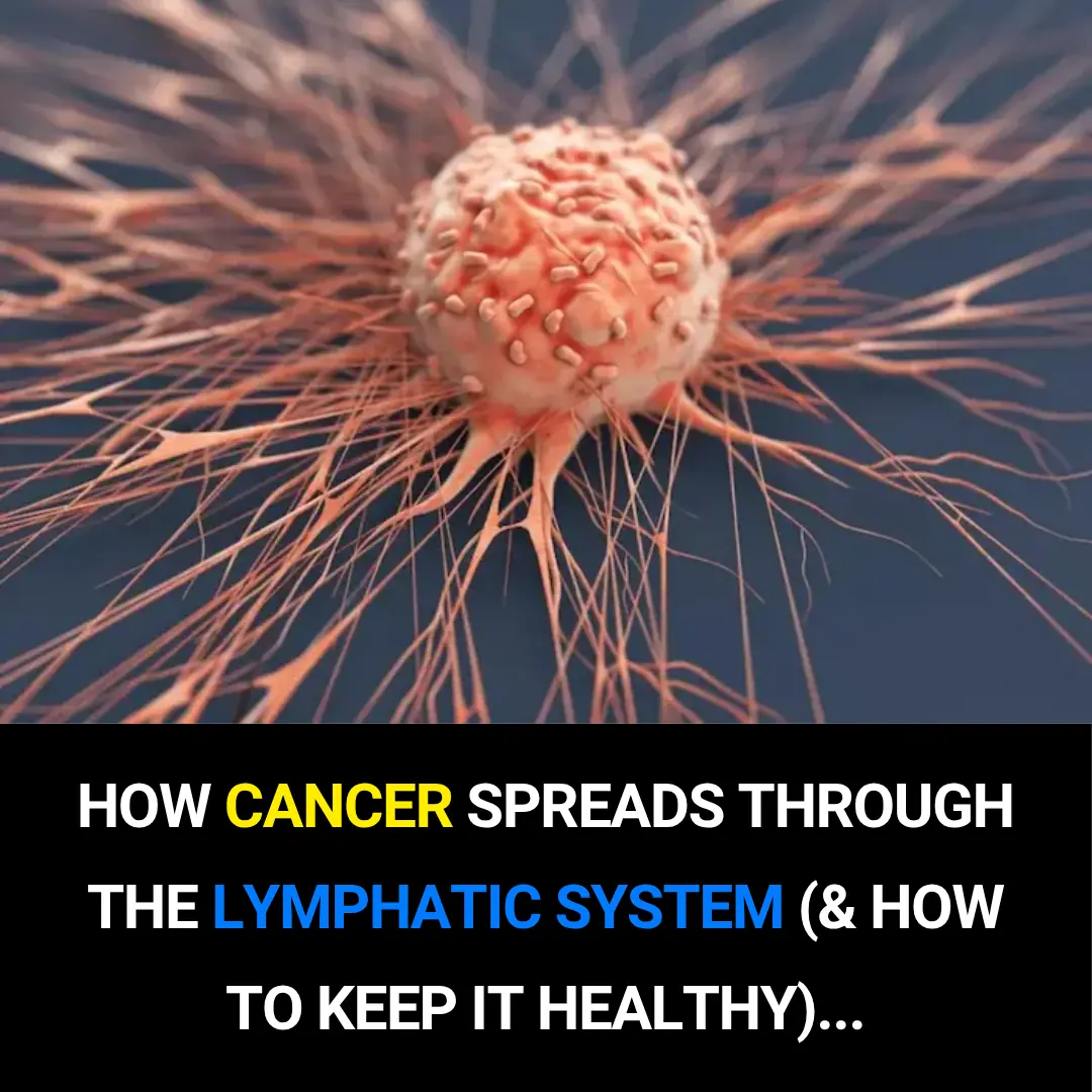 How Cancer Travels Through the Lymphatic System—and Ways to Keep It Strong