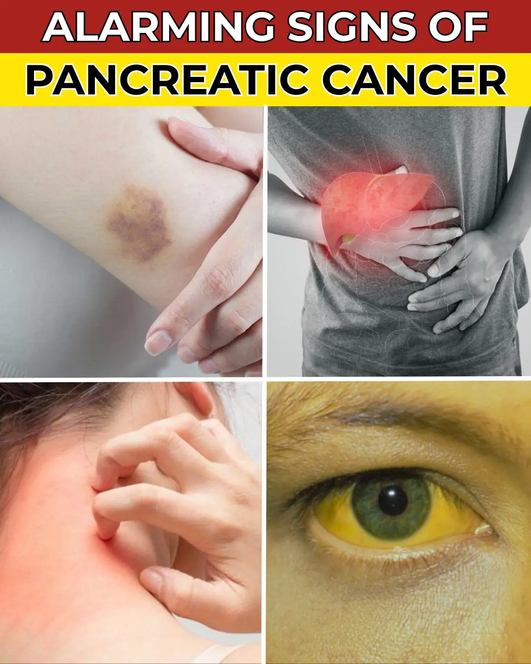 DON'T IGNORE! Top 8 Warning Signs Of Blood Clots