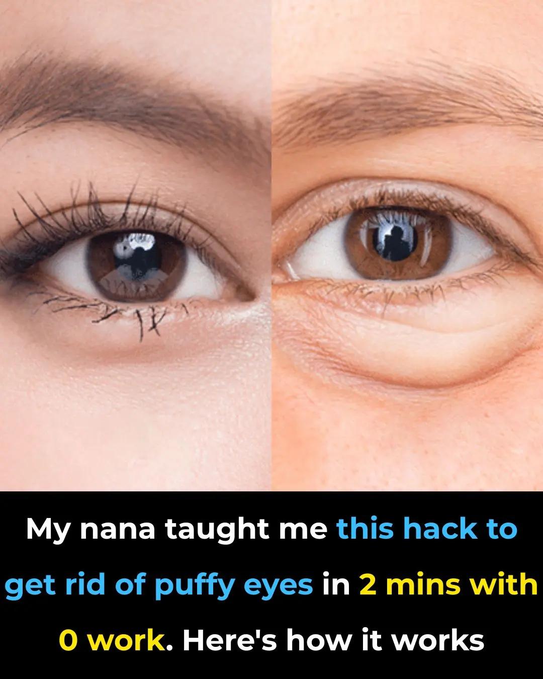 My nana taught me this hack to get rid of puffy eyes in 2 mins with 0 work. Here’s how it works