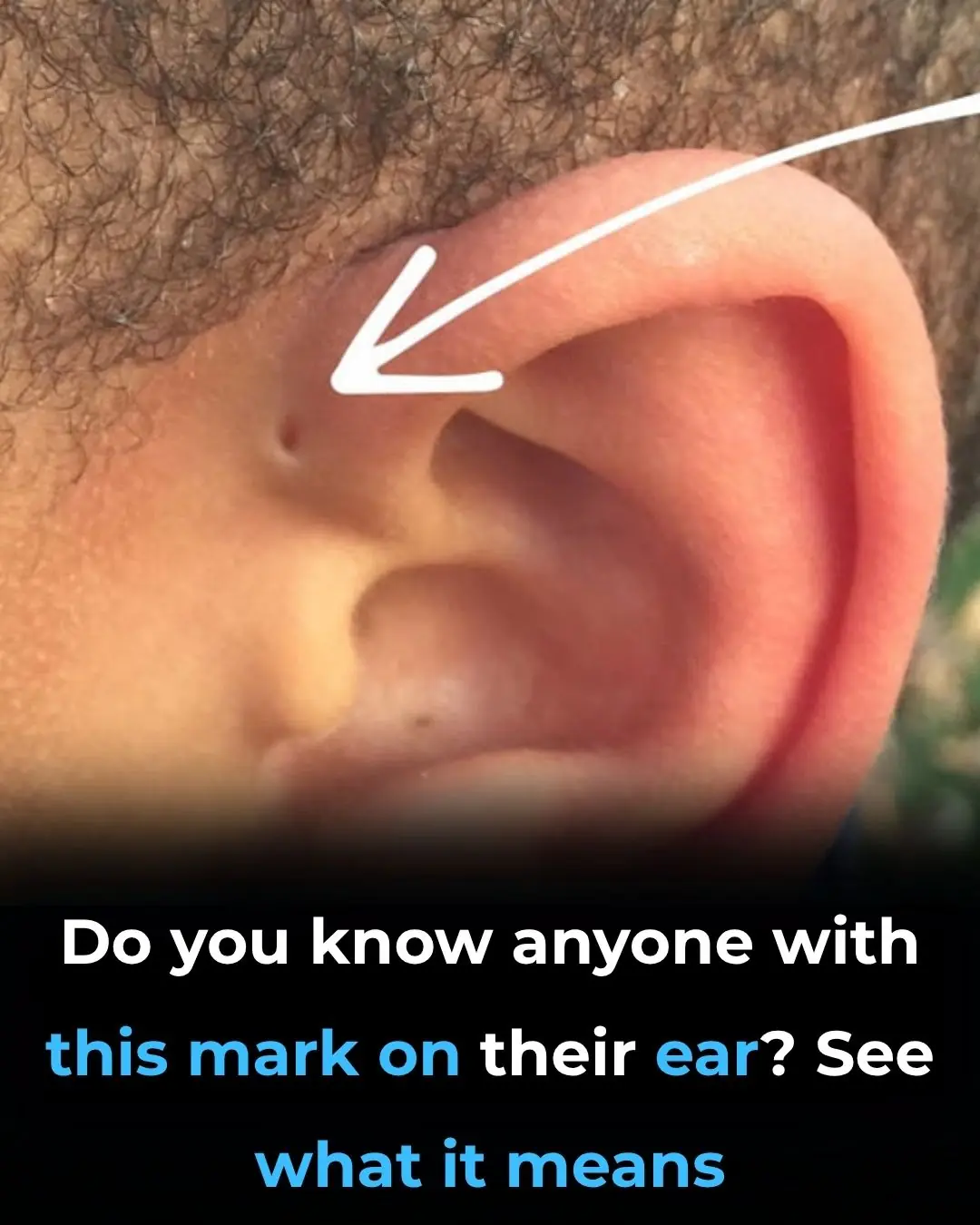 What Does This Little Mark On The Ear Mean